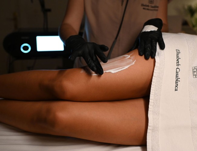 Indiba en piernas en zaragoza